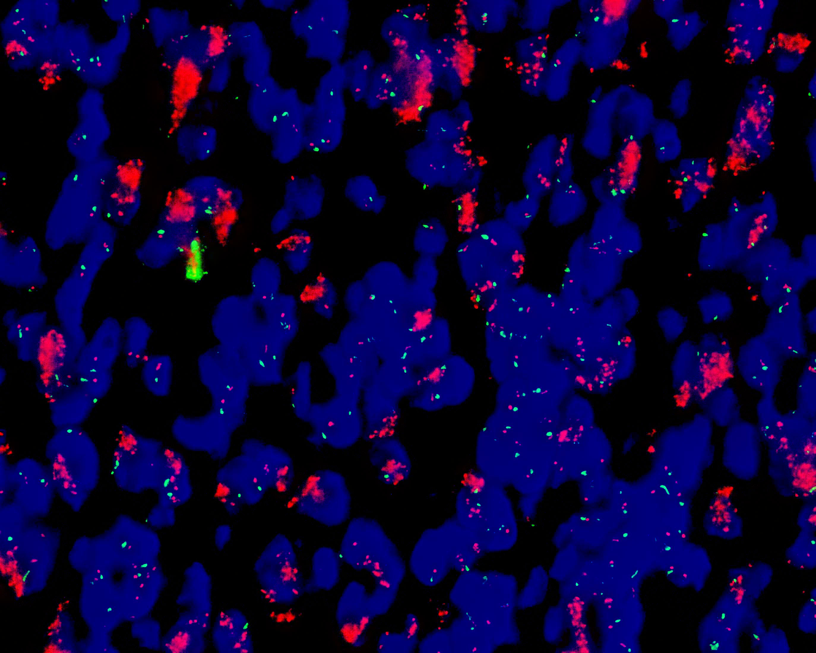 MDM2基因扩增探针试剂（原位杂交法）-武汉康录生物技术股份有限公司
